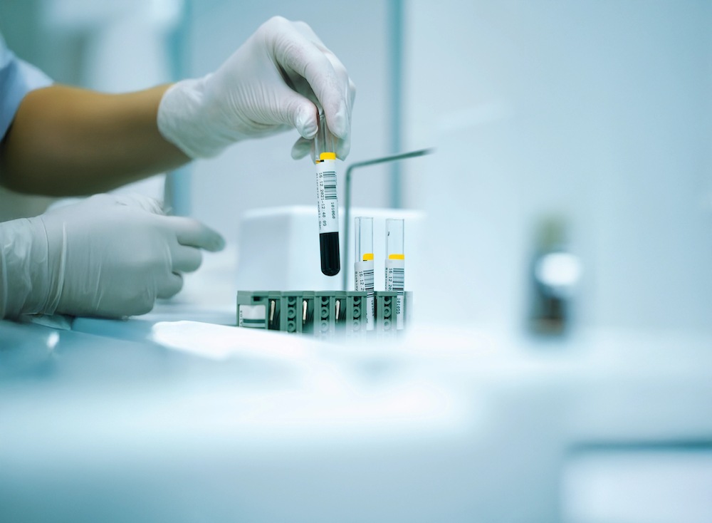 A test titkos nyelve - Mit mesél egy csepp vér a vérvétel során